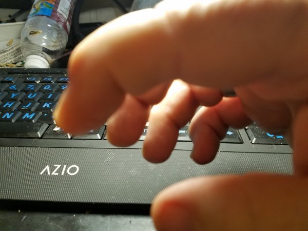 arthritic fingers. .jpg