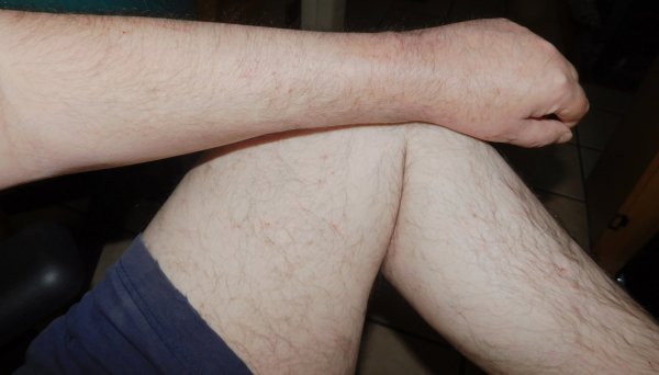 18 June 2018 Left arm- leg.JPG