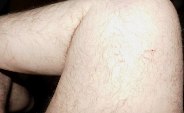 18 June 2018 Right  leg.JPG