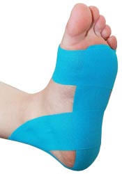 BLUE_PLANTAR_FASCIITIS_TAPING.jpg