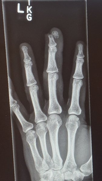 Joe's Finger.jpg