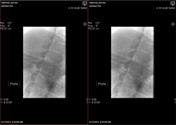 cervical.JPG