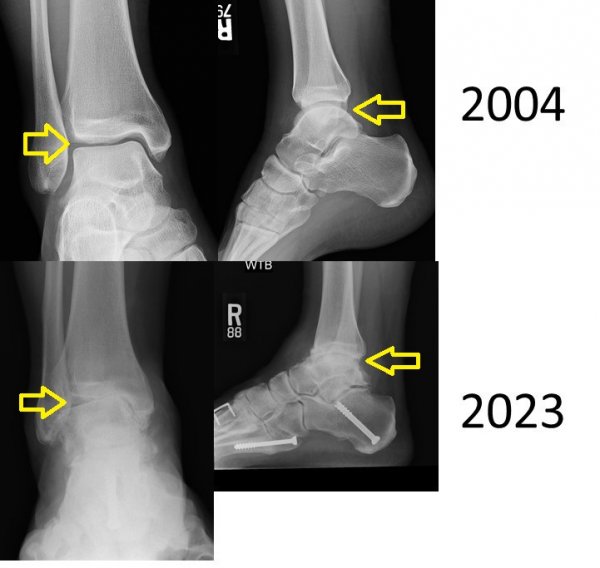 2004 v 2023 arrows.jpg